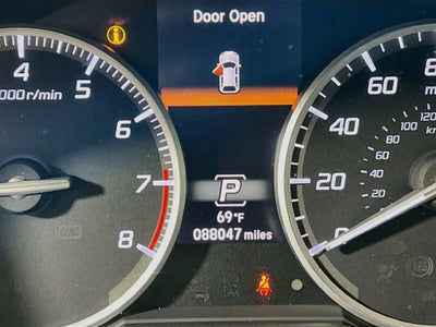 2017 Acura RDX Advance Package